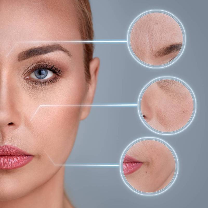 a photo showing skin rejuvenation process of a woman's facial skin