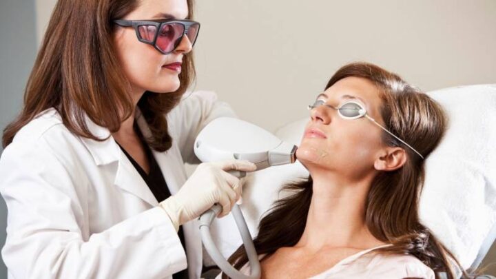 Hair removal laser applied on the chin area