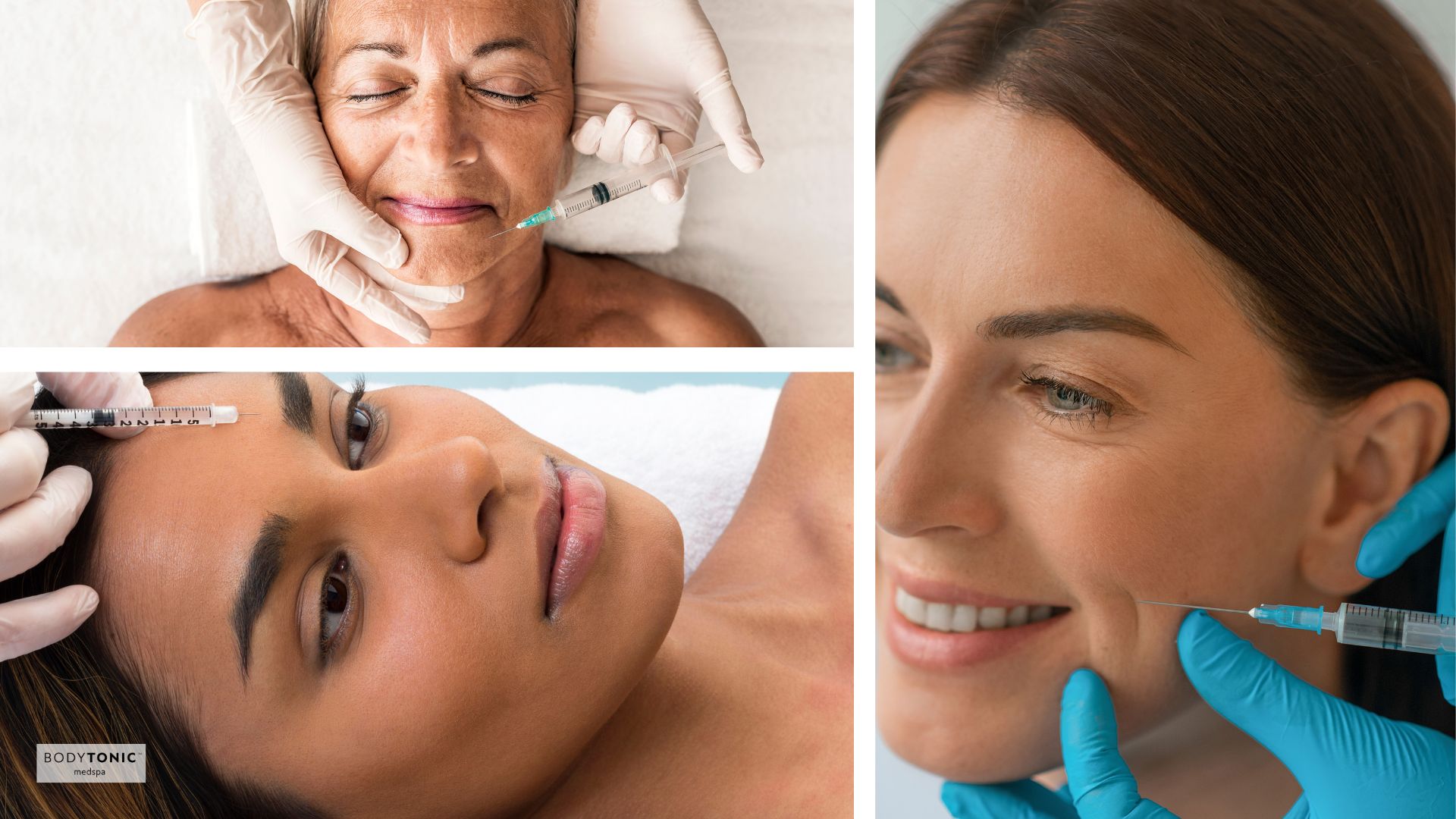 The top Benefits of botox in women of different age ranges