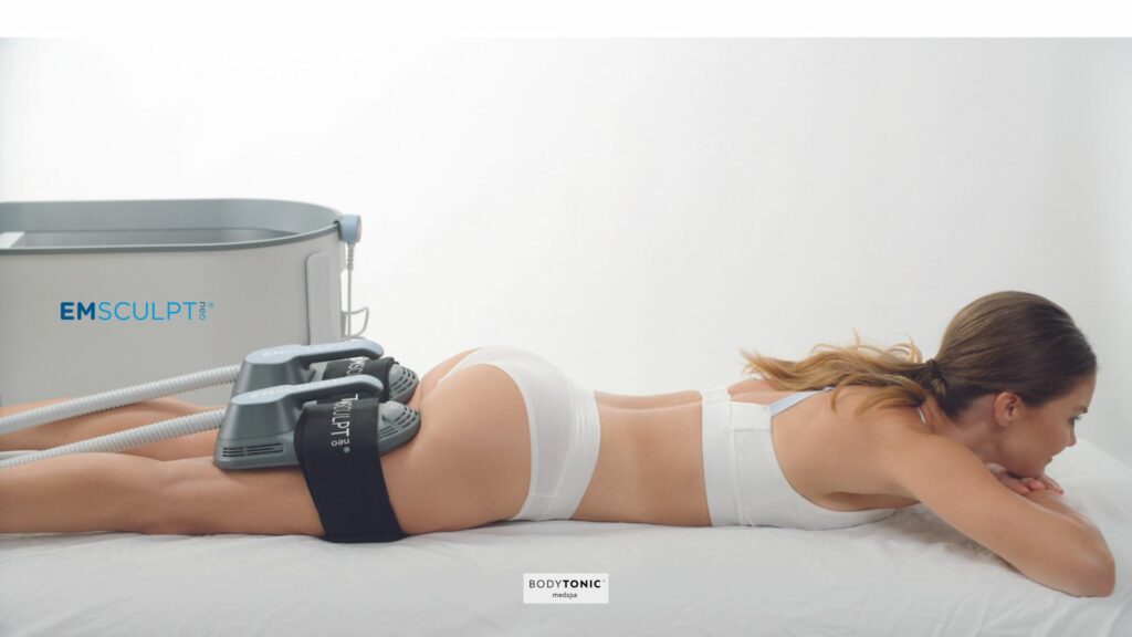 emsculpt neo machine working on a patient glutes
