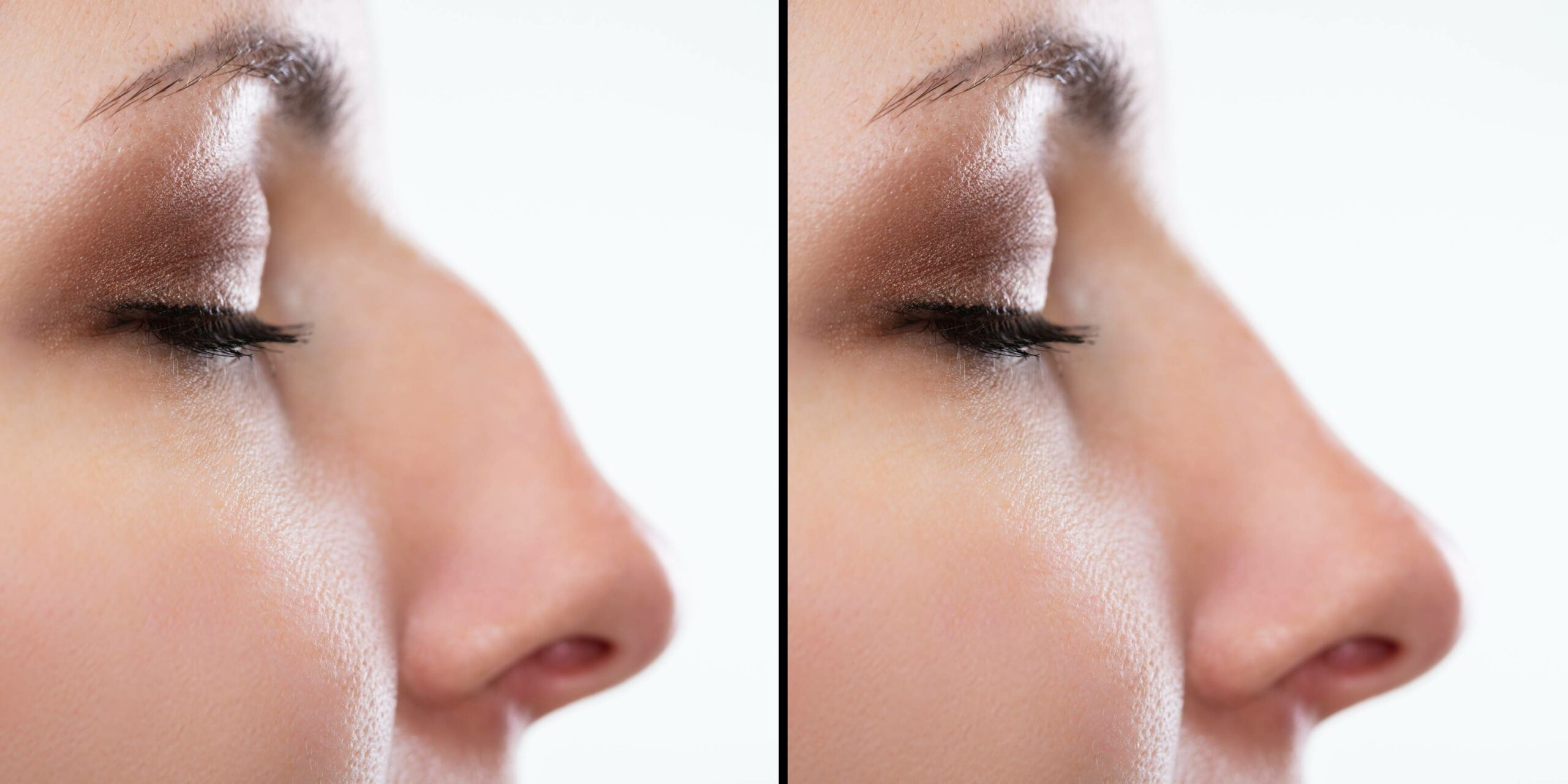 Reshape your chin or nose