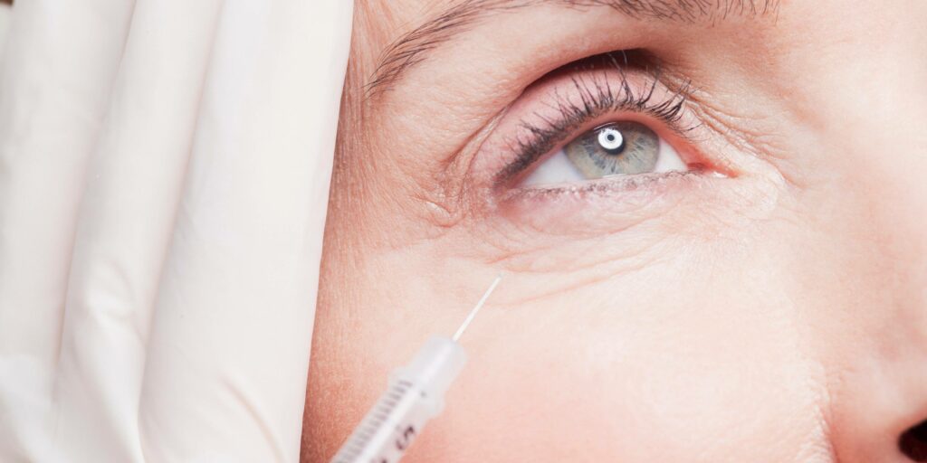 Under eye filler