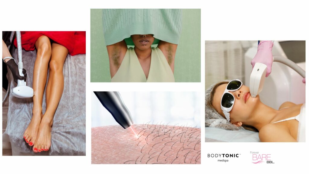 A series of images showcasing laser hair removal treatment being performed on various body parts using a BBL handpiece.