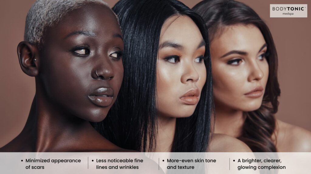 Laser Skin Resurfacing benefits