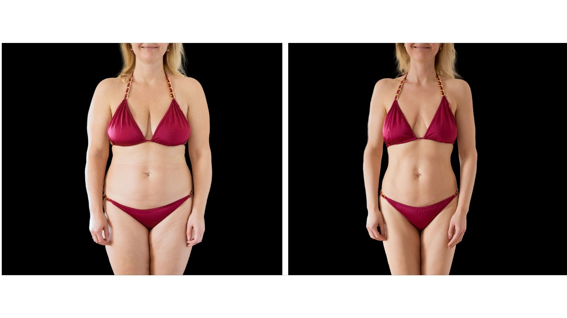 before and after semaglutide injections, Cleveland