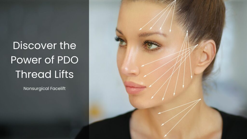 PDO thread lift at bodytonic medspas cleveland