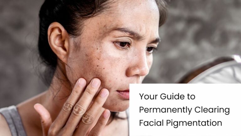 A close up of a middle age woman with sun spots in her face and a sign of suffering from hyperpigmentation