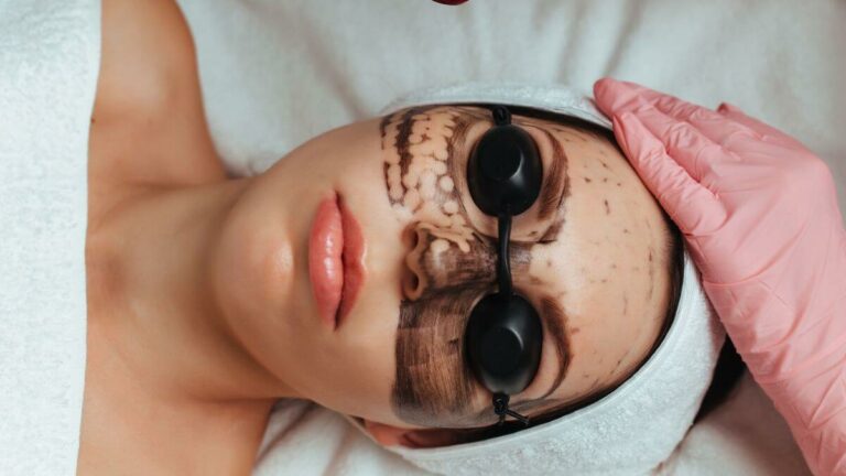 Get rid of melasma forever - Cleveland