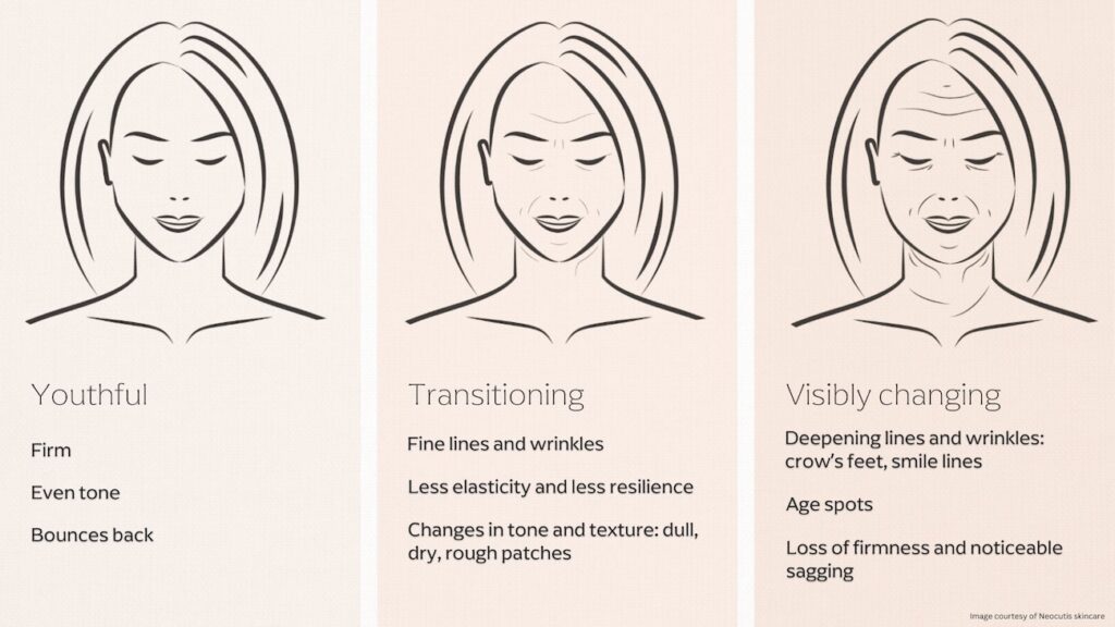Illustration of a woman aging from her 20s to 60s, showing smooth skin in her 20s, early wrinkles and sagging in her 40s, and deeper lines in her 60s due to collagen loss. Highlights the benefits of considering when to start Botox, often in the late 20s or early 30s, to prevent early aging signs.
