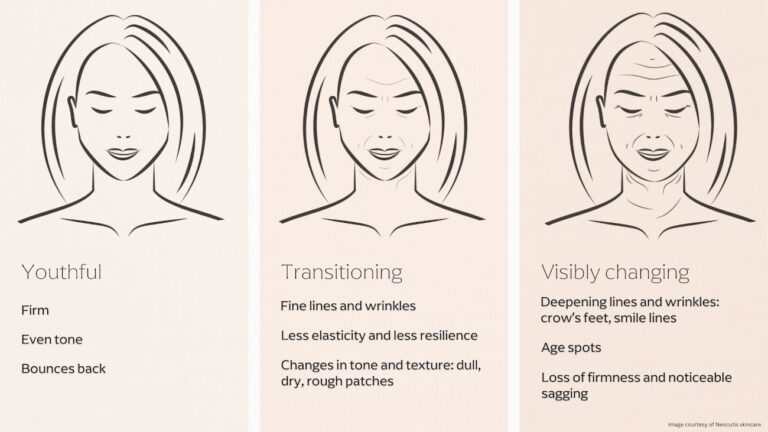 Illustration of a woman aging from her 20s to 60s, showing smooth skin in her 20s, early wrinkles and sagging in her 40s, and deeper lines in her 60s due to collagen loss. Highlights the benefits of considering when to start Botox, often in the late 20s or early 30s, to prevent early aging signs.