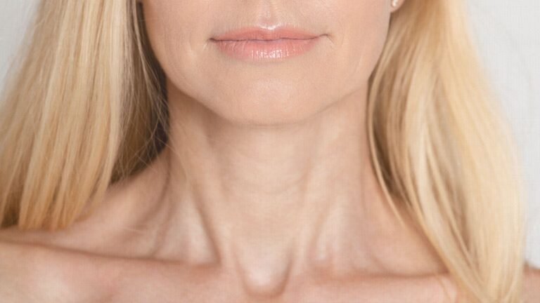 Saggy neck skin after losing weight on a middle-aged woman, showing how RF microneedling at BodyTonic helps tighten and smooth the neck and décolletage