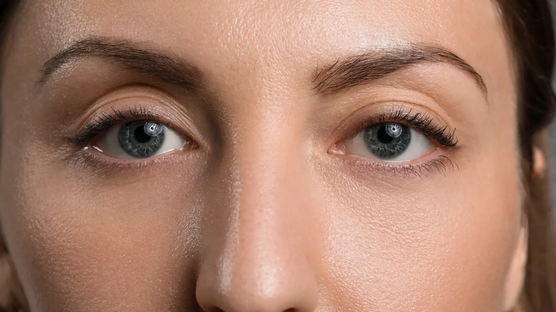 Close-up of a woman with symmetrical, evenly aligned eyes and smooth midface after eye asymmetry correction where one eye looked smaller than the other. BodyTonic MedSpa Cleveland