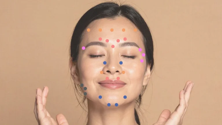 Facial anatomy for Botox and fillers illustrated on a woman’s face with mapped injection points showing key treatment areas for natural results.