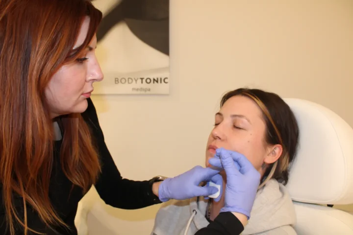 A professional administering Sculptra injections to a client at BodyTonic Med Spa, showcasing the collagen-stimulating treatment in action. Sculptra injections lift, volumize, and rejuvenate the face and body, smoothing wrinkles and restoring firmness. Explore long-term benefits for cheeks, buttocks, and more. Book your Sculptra injections consultation today! Cleveland, Ohio