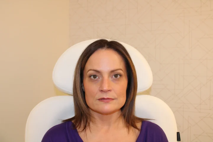 Middle-aged woman showing smooth forehead results after wrinkle relaxer treatment at BodyTonic Medspa in Cleveland.