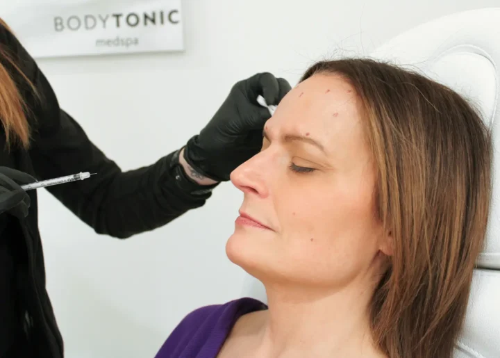 Close-up of a woman receiving a wrinkle relaxer injection on the forehead at BodyTonic Medspa in Cleveland.