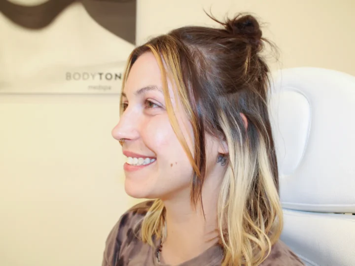 A joyful woman with highlighted hair at BodyTonic Med Spa, displaying the benefits of cosmetic fillers. Expertly administered dermal fillers such as Juvederm®, Restylane®, and Radiesse® lift cheeks, smooth wrinkles, and rejuvenate naturally. Discover FDA-approved cosmetic fillers for instant volume and definition with no downtime. Schedule your consultation for tailored hyaluronic acid or bio-stimulator treatments now! Cleveland, Ohio.